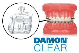 брекеты damon clear