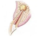 https://dentumclinic.ru/upload/userfiles/file/gran.jpg