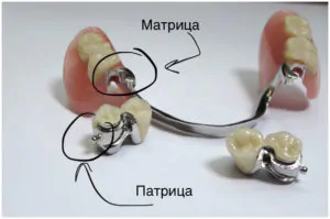 Строение замкового бюгеля Bredent