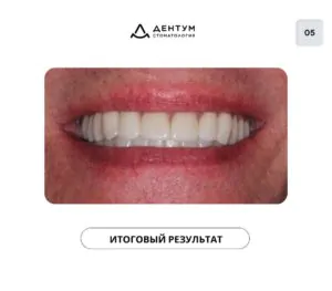 Итоговый результат
