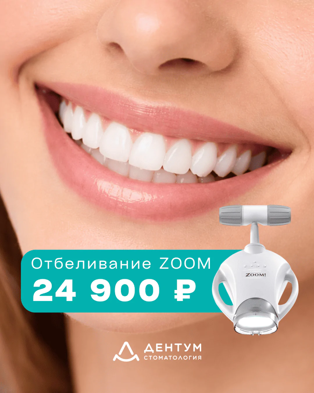 Отбеливание зубов ZOOM 4 — 24 900 ₽